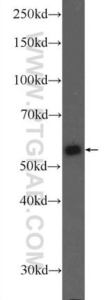 PKM Antibody in Western Blot (WB)