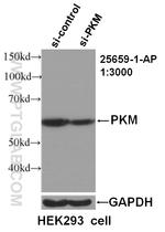 PKM Antibody in Western Blot (WB)