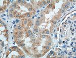 TTC17 Antibody in Immunohistochemistry (Paraffin) (IHC (P))