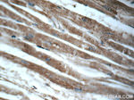 CHCHD10 Antibody in Immunohistochemistry (Paraffin) (IHC (P))