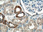 CHCHD10 Antibody in Immunohistochemistry (Paraffin) (IHC (P))