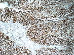 CD63 Antibody in Immunohistochemistry (Paraffin) (IHC (P))