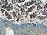 CD63 Antibody in Immunohistochemistry (Paraffin) (IHC (P))
