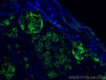 CD63 Antibody in Immunohistochemistry (PFA fixed) (IHC (PFA))