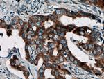 BAIAP2L1 Antibody in Immunohistochemistry (Paraffin) (IHC (P))