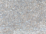 TACC3 Antibody in Immunohistochemistry (Paraffin) (IHC (P))