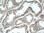 TACC3 Antibody in Immunohistochemistry (Paraffin) (IHC (P))