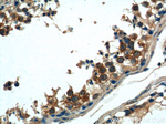 TACC3 Antibody in Immunohistochemistry (Paraffin) (IHC (P))