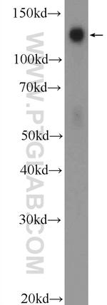 TACC3 Antibody in Western Blot (WB)