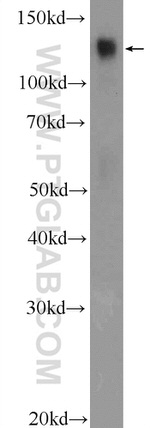 TACC3 Antibody in Western Blot (WB)