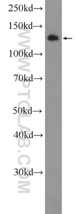 TACC3 Antibody in Western Blot (WB)