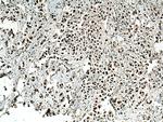 RPUSD2 Antibody in Immunohistochemistry (Paraffin) (IHC (P))