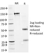 GAD1/GAD67 Antibody in SDS-PAGE (SDS-PAGE)