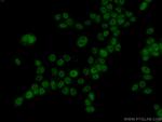 KIAA1429 Antibody in Immunocytochemistry (ICC/IF)