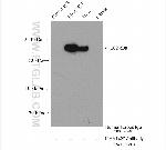 KIAA1429 Antibody in Immunoprecipitation (IP)