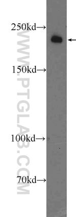 KIAA1429 Antibody in Western Blot (WB)