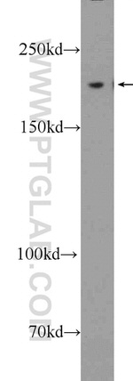 KIAA1429 Antibody in Western Blot (WB)