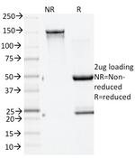 GAD2/GAD65 Antibody in SDS-PAGE (SDS-PAGE)