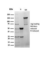 GAD2/GAD65 (GABAergic Neuronal Marker) Antibody in SDS-PAGE (SDS-PAGE)