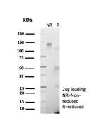 GAD2/GAD65 (GABAergic Neuronal Marker) Antibody in SDS-PAGE (SDS-PAGE)