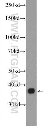 LPPR2 Antibody in Western Blot (WB)