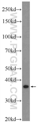 ANKRD54 Antibody in Western Blot (WB)