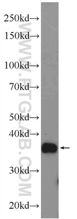 ANKRD54 Antibody in Western Blot (WB)