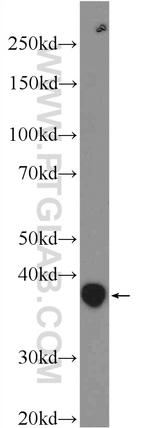 ANKRD54 Antibody in Western Blot (WB)