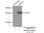 ZMYM3 Antibody in Immunoprecipitation (IP)