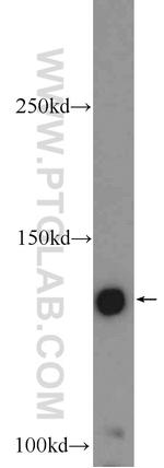 ZMYM3 Antibody in Western Blot (WB)