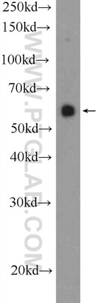 RAPH1 Antibody in Western Blot (WB)