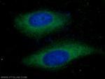 COX20 Antibody in Immunocytochemistry (ICC/IF)