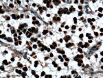 OLIG2 Antibody in Immunohistochemistry (Paraffin) (IHC (P))