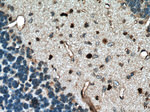 OLIG2 Antibody in Immunohistochemistry (Paraffin) (IHC (P))