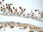 C9orf72 Antibody in Immunohistochemistry (Paraffin) (IHC (P))