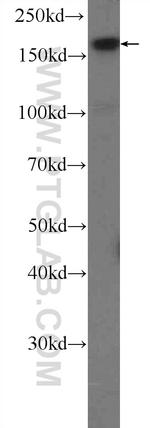 USP19 Antibody in Western Blot (WB)