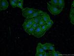 Drebrin Antibody in Immunocytochemistry (ICC/IF)