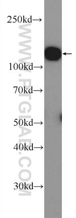 Drebrin Antibody in Western Blot (WB)