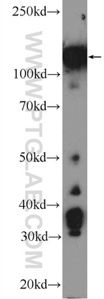 Drebrin Antibody in Western Blot (WB)