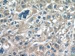 UQCC2 Antibody in Immunohistochemistry (Paraffin) (IHC (P))