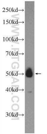 ZNF394 Antibody in Western Blot (WB)