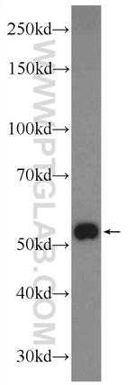 ZNF394 Antibody in Western Blot (WB)