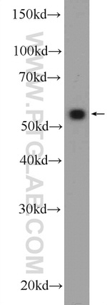 ZNF394 Antibody in Western Blot (WB)