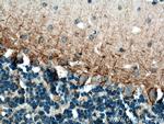 NF-M Antibody in Immunohistochemistry (Paraffin) (IHC (P))