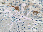 NF-M Antibody in Immunohistochemistry (Paraffin) (IHC (P))