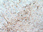 NF-M Antibody in Immunohistochemistry (Paraffin) (IHC (P))