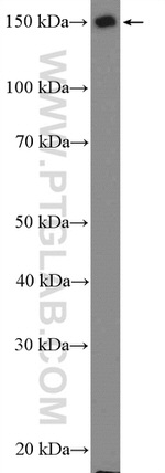 NF-M Antibody in Western Blot (WB)