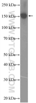 ZC3H18 Antibody in Western Blot (WB)