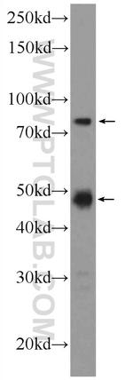 SETMAR Antibody in Western Blot (WB)