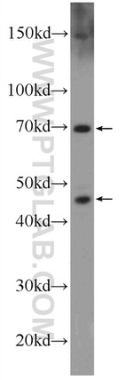 SETMAR Antibody in Western Blot (WB)